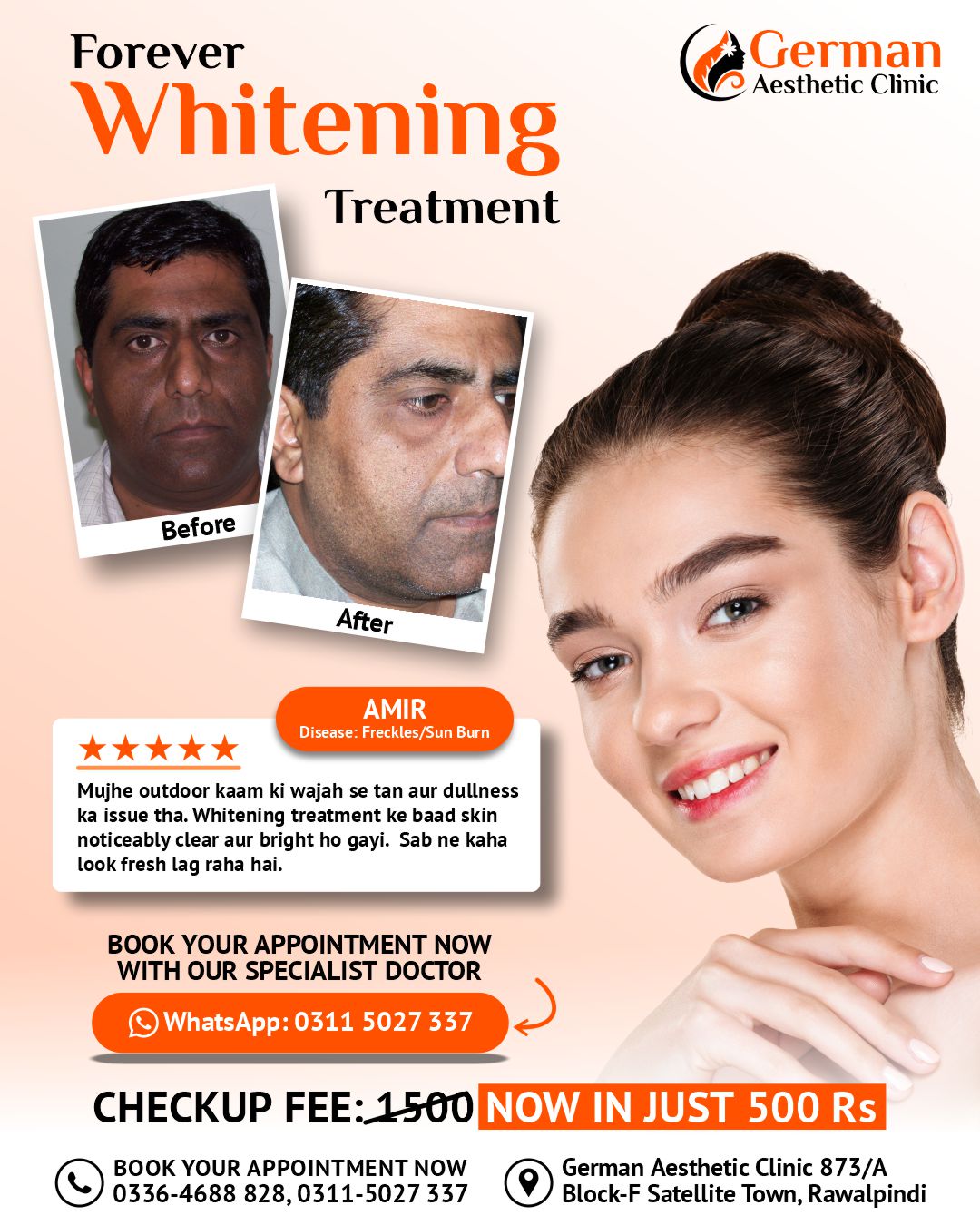 Forever Whitening Treatment