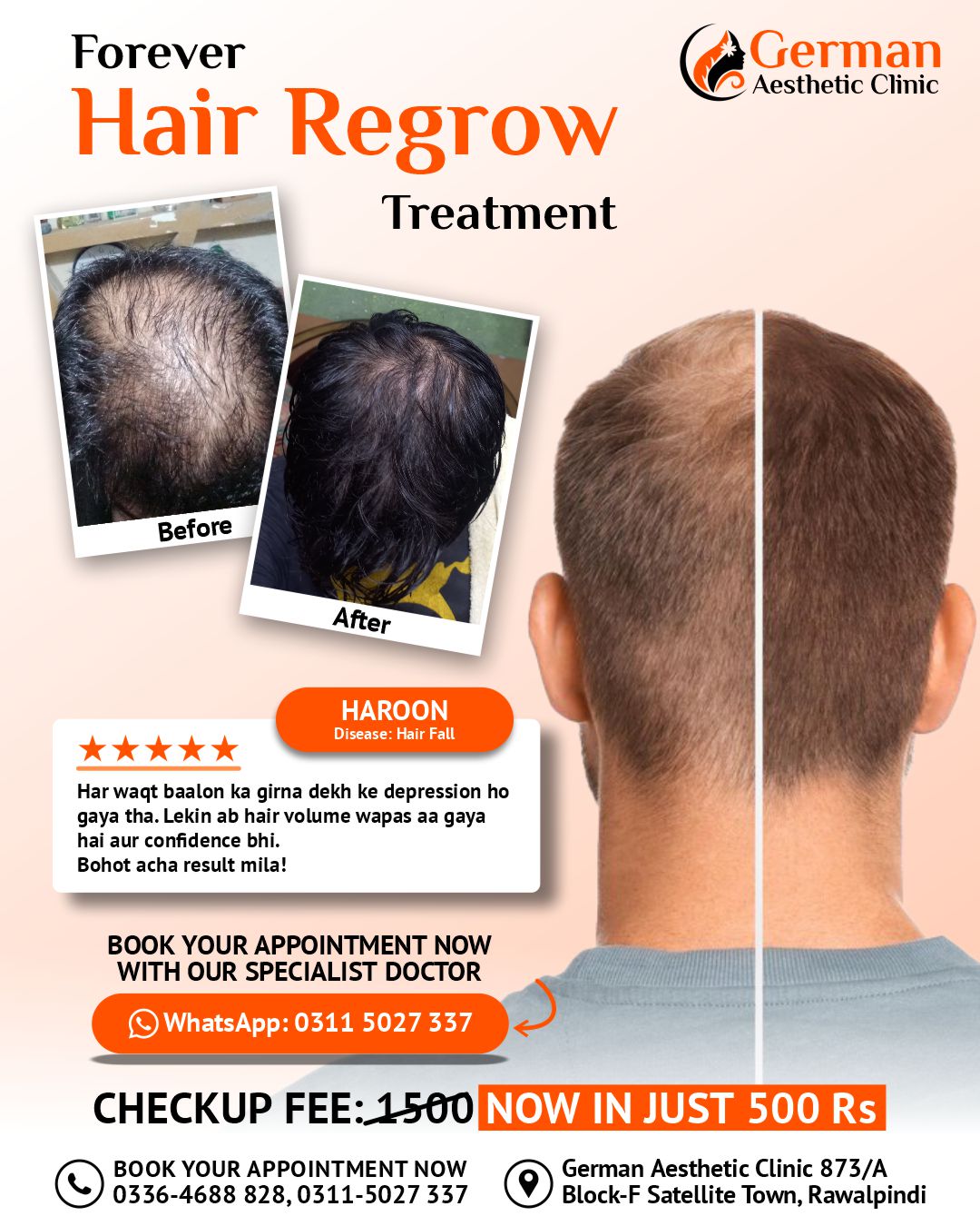 Hair Regrow Treatment